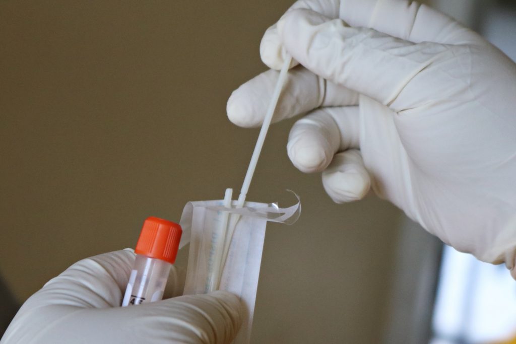 Test antigénique ou PCR